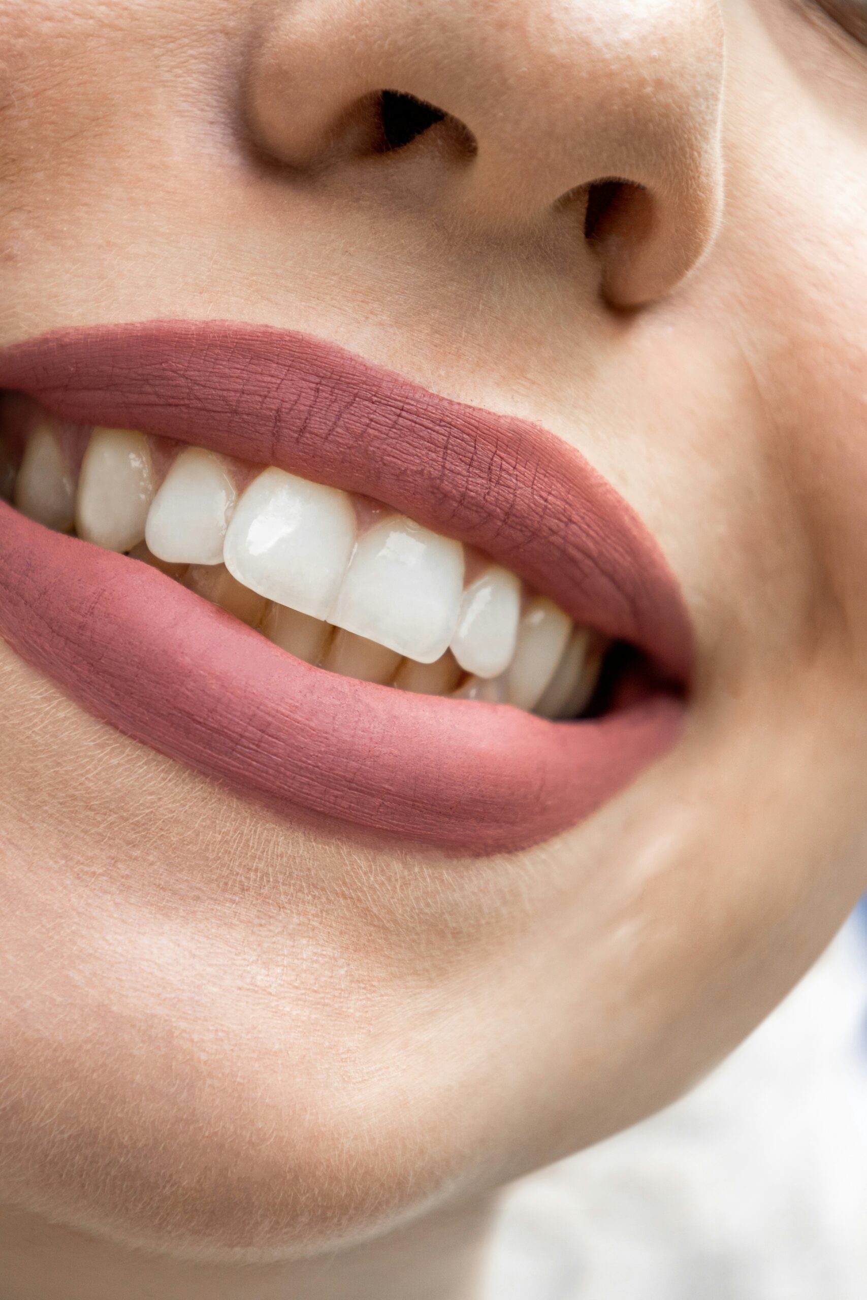 Cosmetic Dental